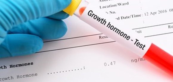 בדיקת הורמון גדילה (Growth Hormone) - תמונה